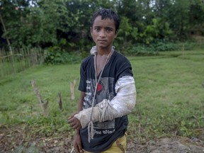Mohammad Suhail, a Rohingya Muslim boy, who said he was shot by Myanmarese army after they killed his parents, stands on the side of a road after collecting aid at Taiy Khali refugee camp, Bangladesh, Thursday, Sept. 21, 2017. More than 500,000 Rohingya Muslims have fled to neighboring Bangladesh in the past year, most of them in the last three weeks, after security forces and allied mobs retaliated  to a series of attacks by Muslim militants last month by burning down thousands of Rohingya homes in the predominantly Buddhist nation. (AP Photo/Dar Yasin)