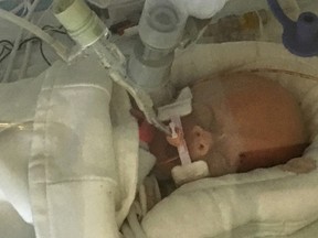 In this Sept. 8, 2017 file photo provided by Sonya Nelson, Life Lynn DeKlyen lies in the Neonatal Intensive Care Unit of the University of Michigan Hospital in Ann Arbor, Mich.