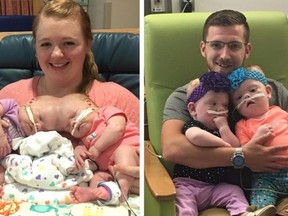 Left: Heather Delaney holds conjoined twins Abby and Erin. Right: Riley Delaney holds the girls after their separation surgery.