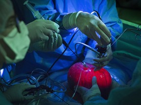 Surgeons use an experimental technique in which the uterus is lifted from a woman’s body to operate upon a fetus with spina bifida, at the Texas Children’s Hospital in Houston, Sept. 26, 2017.