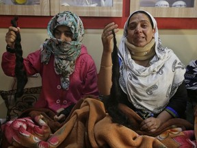 In this Sept 18, 2017 photo, Tasleema Bilal , right, and her teenage niece Kousain Ajaz, show their chopped braids inside their home in Srinagar, India.  Unidentified assailants have chopped off long-braided hair of over 100 mostly teenage girls and young women since last month in Indian-controlled Kashmir. The attacks have intensified fear and panic, protests and even vigilantes in the disputed Himalayan region, where most population is already exhausted and traumatized by decades of brutal conflict. (AP Photo/Mukhtar Khan)