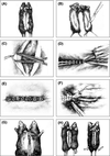 Illustrations of stages of the parabiosis surgery adapted from photographs in Conboy & Conboy