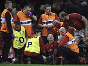 Wales' Jonathan Davies receives treatment during the game against Australia, during their Autumn International match at the Principality Stadium in Cardiff, Wales, Saturday Nov. 11, 2017. (Mike Egerton/PA via AP)