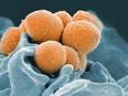 This handout image provided by the National Institute of Allergy and Infectious Diseases shows an electron microscope image of Group A Streptococcus (orange) during phagocytic interaction with a human neutrophil (blue). Health officials have issued an alert, saying nine people have died in an ongoing invasive group. A streptococcus outbreak in the London, Ont., area.