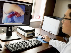 In this Sept. 21, 2017, photo, Dr. David Song looks at surgical images in his office at MedStar Georgetown University Hospital in Washington. Song performs a type of surgery called lymph node transfer to ease lymphedema in the arm, severe swelling that can be a lasting side effect of breast cancer treatment. (AP Photo/Andrew Harnik)