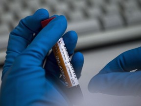 FILE In this Tuesday, May 24, 2016 file photo an employee of the Russia's national drug-testing laboratory holds a vial in Moscow, Russia. A Russian doping whistleblower's lawyer says FIFA has made no attempt to gain information about "many" footballers embroiled in the widespread conspiracy. Lawyer Jim Walden told The Associated Press that Grigory Rodchenkov's has "information about Russian footballers being protected by the state sponsored doping system."