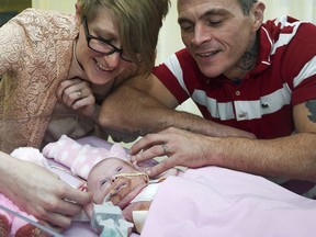 Naomi Findlay and Dean Wilkins, look at their daughter, three-week-old Vanellope Hope Wilkins who was born with an extremely rare condition in which the heart grows on the outside of the body, at Glenfield Hospital in Leicester, Monday Dec. 11, 2017.