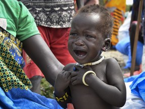 In this photo taken Sunday, Dec. 10, 2017, a malnourished baby cries at the feeding center for children in Jiech, Ayod County, South Sudan. As South Sudan enters its fifth year of civil war, 1.25 million people are facing starvation, according to the latest analysis by the United Nations and the government.