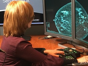 In this Nov. 21, 2017 photo provided by the Montefiore Health System, Dr. Tova Koenigsberg at The Montefiore Einstein Center for Cancer Care in New York shows an example of a traditional mammogram scan. U.S. health officials are beginning a huge study to compare traditional mammograms with 3-D versions, to see if the newer choice might really improve screening for breast cancer. (Montefiore Health System via AP)