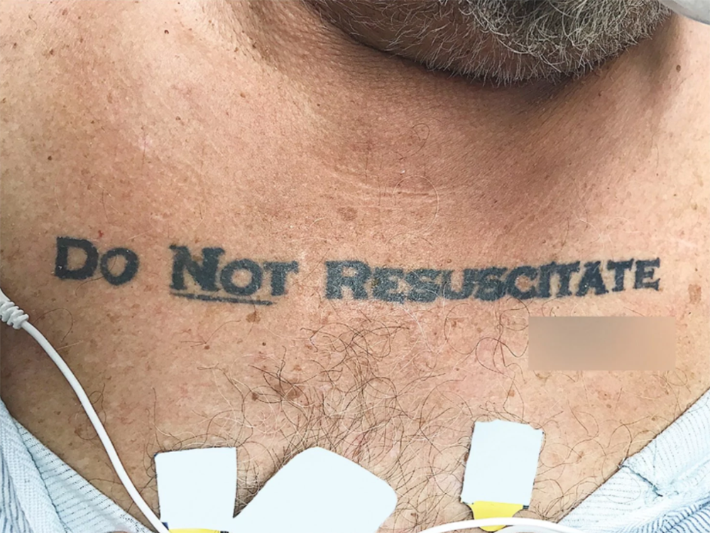 When a tattoo says 'do not resuscitate,' should doctors obey?