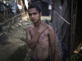 In this Friday Nov. 24, 2017, photo, Mohammadul Hassan, 18, is photographed outside his family's tent in Jamtoli refugee camp in Bangladesh. Hassan still bears the scars on his chest and back from being shot by soldiers who attempted to execute him. More than 650,000 Rohingya Muslims have fled to Bangladesh from Myanmar since August, and many have brought with them stories of atrocities committed by security forces in Myanmar, including an Aug. 27 army massacre that reportedly took place in the village of Maung Nu.