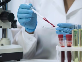 Clinical laboratory testing plays a crucial role in the detection, diagnosis and treatment of disease.