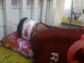 In this Tuesday, Jan. 16, 2018, image made from video, a man recovers from a head wound in a hospital after being allegedly involved in a protest confrontation with police during a local festival in the ancient city of Mrauk-U, Rakhine, western Myanmar. Officials say local police opened fire at hundreds of protesters angry about a ban on a local festival, killing seven people. (DVB via AP)