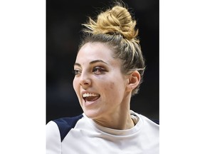 Connecticut's Katie Lou Samuelson, with a black eye, smiles as she warms up for the team's NCAA college basketball game against Tulsa, Thursday, Jan. 18, 2018, in Storrs, Conn.