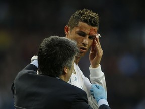 Real Madrid's Cristiano Ronaldo bleeds from his forehead during a Spanish La Liga soccer match between Real Madrid and Deportivo Coruna at the Santiago Bernabeu stadium in Madrid, Sunday, Jan. 21, 2018.