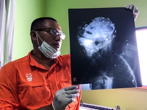 In this Tuesday, Feb. 6, 2018 photo released by Center for Orangutan Protection (COP), Principal of COP Hardi Baktiantoro holds an x-ray showing air rifle pellets lodged in the head and body of an orangutan during its surgery in East Kalimantan, Indonesia.