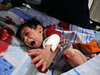 A Syrian child screams of pain as he gets emergency treatment at a makeshift hospital in Douma, following reported bombardment by regime forces of the rebel-held town, on the outskirts of the capital Damascus on Feb. 1, 2018.