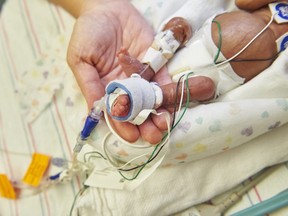 An artificial womb could help keep babies born severely premature alive.
