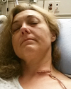 Kim Schellenberg, who landed in hospital after accidentally swallowing a barbecue brush bristle.