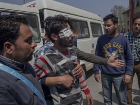Kashmiri men help a wounded man at a hospital after he got hit by pellets fired by Indian forces during a protest in Srinagar, Indian controlled Kashmir, Sunday, April 1, 2018. Deadly protests against Indian rule erupted in several parts of Indian-controlled Kashmir on Sunday following the killings of at least eight rebels in fighting with government forces, officials said.