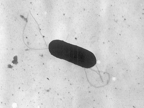 This 2002 electron microscope image made available by the Centers for Disease Control and Prevention shows the kind of listeria bacteria that is behind some food poisoning outbreaks.