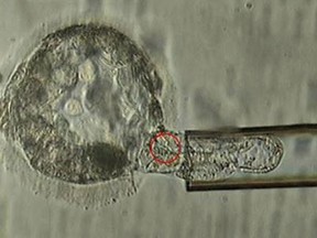 This undated microscope image provided by the American Society for Reproductive Medicine in January 2018 shows a trophectoderm biopsy, in which cells from the outer layer of an embryo that develop into the placenta and amniotic membranes are removed and can be used for genetic testing. When a couple is known to be at risk for having a child with a specific genetic disorder, the woman undergoes a procedure to remove some of her eggs. After fertilization, some cells can be plucked from the embryos and examined to identify those without carry the disease-causing abnormality. (ASRM via AP)Wedn