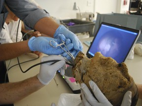 A photo provided by the Museum of Fine Arts, Boston, of a team of doctors from Massachusetts General Hospital extracting a tooth from the mummy head in 2009, hoping to extract DNA.The museum called on the FBI to see if its scientists could extract genetic material from the 4,000-year-old mummy, to figure out whom the head belonged to.
