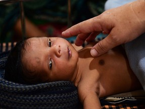 A sick infant is treated at a Doctors Without Borders clinic at Kutupalong refugee camp in Bangladesh's Ukhia district April 9, 2018.