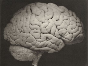 This 1885 photo shows a side view of a human brain. In relation to body size, our brains are huge, about six times larger than one would expect from other mammals. And this three-pound organ sucks up fully 20 percent of the body's energy needs.
