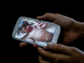A doctor shows on her mobile phone a photo of Fadl, an 8-month-old Yemeni boy taken in his last days before he starved to death, in this Feb. 10, 2018 photo at a hospital in Mocha, Yemen. Fadl's mother gave birth to him under a tree as she fled fighting, and ever since she struggled to get him enough food. Eight months later, at the time of his death, the baby boy weighed 2.9 kilograms (6 pounds), a third of the normal weight for his age.