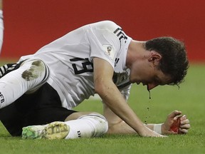 Blood drips from the nose of Germany's Sebastian Rudy during the group F match between Germany and Sweden at the 2018 soccer World Cup in the Fisht Stadium in Sochi, Russia, Saturday, June 23, 2018.