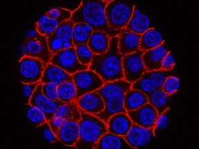 This undated microscope image from USC via the NIH shows pancreatic cancer cells, nuclei in blue, growing as a sphere encased in membranes, red.