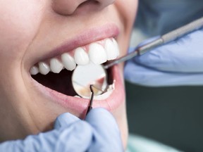 Many people will be affected if dentists pull out of public health care system.