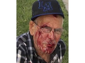 This July 4, 2018 photo released by Misbel Borjas shows Rodolfo Rodriguez on a sidewalk in the unincorporated Willowbrook area in Los Angeles, Calif. A woman has been arrested in the investigation of the beating of a 92-year-old man in Southern California. The Los Angeles County Sheriff's Department says detectives took 30-year-old Laquisha Jones into custody late Tuesday in Los Angeles and booked her into jail for investigation of assault with a deadly weapon.