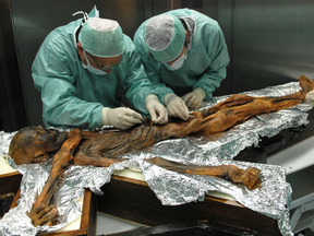 An examination of the body of a frozen hunter known as Otzi the Iceman to sample his stomach contents offered scientists a snapshot of what ancient Europeans ate more than five millennia ago.