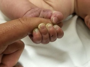 This Sunday, July 8, 2018 photo provided by the Missoula County Sheriff's Office shows a 5-month-old infant with dirt under their fingernails after authorities say the baby survived about nine hours being buried under sticks and debris in the woods. The Missoula County Sheriff's Office says the baby is in good condition at a hospital and calls it a "miracle" that the child survived the weekend ordeal. Authorities say they were called about a man threatening people in the Lolo Hot Springs area of western Montana's Lolo National Forest. Deputies apprehended the man who indicated that the baby was buried somewhere in the woods. (Missoula County Sheriff's Office via AP)