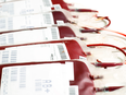 Canadian Blood Services said 46 per cent of Canada's population has group-O blood, while 42 per cent is group A, nine per cent group B, and three per cent group AB.