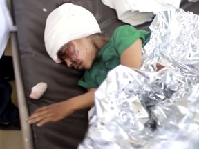 This image made from video taken on Thursday, Aug. 9, 2018, shows a child injured in an airstrike resting at a hospital in Saada, Yemen. Yemen's Shiite rebels are backing a United Nations' call for an investigation into a Saudi-led coalition airstrike in the country's north that killed dozens of people the previous day, including many children.  (AP Video via AP)