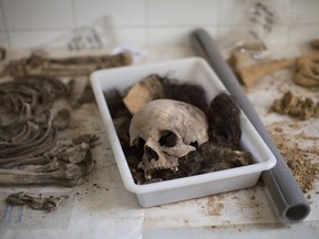 A skull with other bones of a victim's body is classified by anthropologists following an exhumation of a mass grave at the cemetery of Paterna, near Valencia, Spain, Tuesday, Aug. 28, 2018. Archaeologists unearth the remains of some of the 100 people believed to have been executed by the Franco regime near Valencia at the end of Spain's Civil War eight decades ago. The process of exhuming some 130,000 victims from Civil War-era mass graves scattered across the country is gaining momentum under the new center-left government.