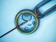 New testing can identify “mosaic” embryos containing a mix of normal and abnormal cells during an active cycle of in vitro fertilization (IVF).