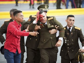In this photo released by China's Xinhua News Agency, an uniformed official bleeds from the head following an incident during a speech by Venezuela's President Nicolas Maduro in Caracas, Venezuela, Saturday, Aug. 4, 2018. Drones armed with explosives detonated near Venezuelan President Nicolas Maduro as he gave a speech to hundreds of soldiers in Caracas on Saturday but the socialist leader was unharmed, according to the government.