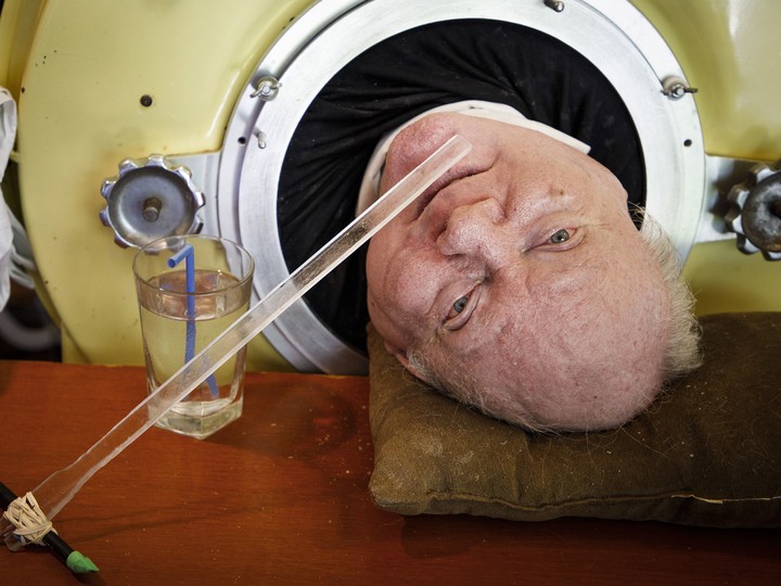  In this April, 2018 photo, U.S. attorney Paul Alexander looks out from inside his iron lung at his home in Dallas. Now in his 70s, Alexander is one of the few people left who uses an iron lung to help facilitate breathing for those affected by polio.