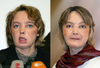 Isabelle Dinoire, at left in February 2006 a few months after her surgery; and, at right, in November 2006.