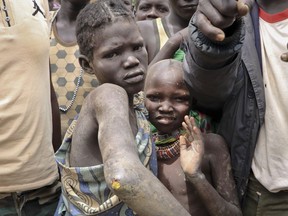 In this photo taken Monday, Aug. 6, 2018, eight-year-old girl Losika Losepio holds up her arm showing the infected cut on her elbow which she got from working in gold mines, in Kapoeta, South Sudan. South Sudan's five-year civil war has devastated the economy, fueling child labor in some of the country's most impoverished regions.