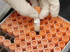 A researcher pulls a frozen vial of human embryonic stem cells at the University of Michigan Center for Human Embryonic Stem Cell Research Laboratory in Ann Arbor, Mich., in this Oct. 22, 2008 file photo.
