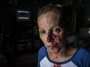 A woman with her face bloodied after she was pummeled by the police, stands in shock inside a house after a peaceful anti-government march was dissolved violently by government forces, in Managua, Nicaragua, Sunday, Sept. 23, 2018. Police and militias opened fire on the demonstrators leaving at least one dead and several wounded, included at least one journalists.