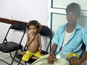 In this Aug. 25, 2018 image made from video, a severely malnourished girl waits for her turn to be treated at the Aslam Health Center in Hajjah, Yemen. Around 2.9 million women and children are acutely malnourished; another 400,000 children are fighting for their lives only a step away from starvation. Yemen's civil war has wrecked the impoverished country's already fragile ability to feed its population.