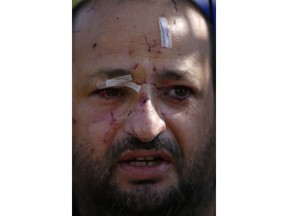 A man injured in an apartment building hit by a rocket fired by Palestinian militants from Gaza, is bandaged in the southern Israeli city of Ashkelon, Israel, Tuesday, Nov. 13, 2018. Gaza militants fired dozens of rockets at southern Israel early on Tuesday, killing a man in a strike on a residential building, and warning they would escalate their attacks if Israel continues bombing targets in the Gaza Strip.