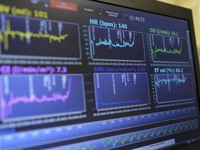 FILE - In this Aug. 27, 2014 file photo, a laptop computer monitors a patient's heart function as he takes a stress test in Augusta, Ga. The American Heart Association conference ending Monday, Nov. 12, 2018 in Chicago revealed a lot about what works and what does not for preventing heart attacks.