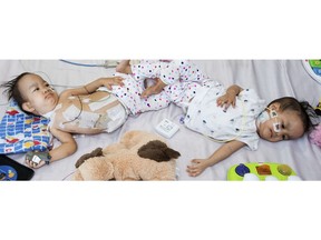 In this Wednesday, Nov. 14, 2018, photo provided by RCH Melbourne Creative Studio, 15-month-old girls, Nima and Dawa lie in their hospital bed following a successful separation surgery last week. The conjoined twins from Bhutan were separated at an Australian hospital Nov. 9, 2018 in a delicate operation that divided their shared liver and reconstructed their abdomens. (The Royal Children's Hospital Melbourne Creative Studio via AP)